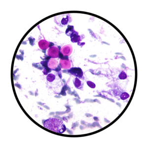 Cryptococcus Sample