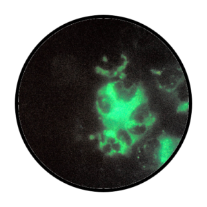 Psittacosis Sample