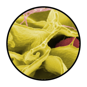 Salmonella Sample